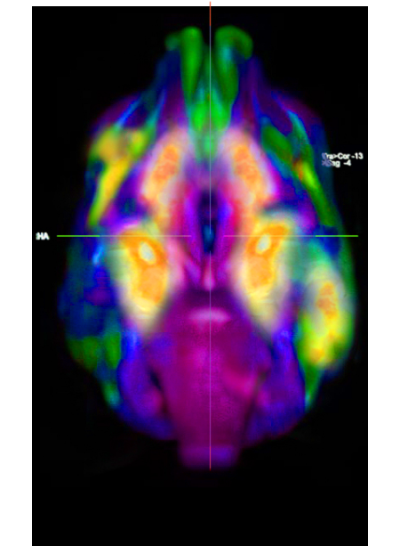 dog-brain-neuro