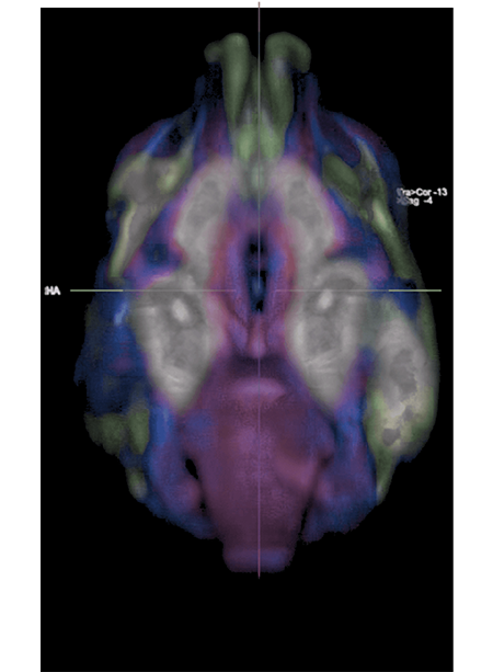 dog-brain